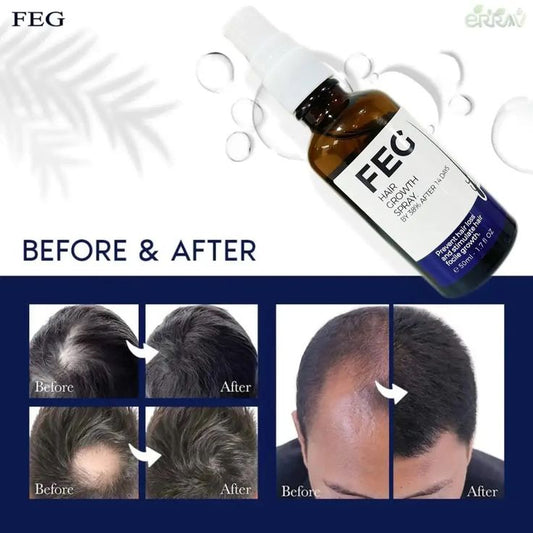 FEG Plus Hair Growth Spray – Fast & Natural Regrowth
