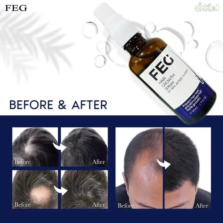 FEG Plus Hair Growth Spray – Fast & Natural Regrowth